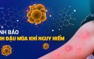 BỆNH ĐẬU MÙA KHỈ- ĐƯỜNG LÂY TRUYỀN VÀ CÁCH PHÒNG BỆNH